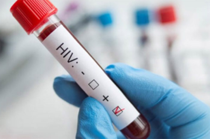 Una mujer logra curarse por primera vez del VIH tras un transplante de células madre